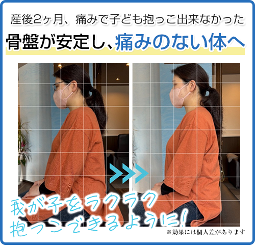 ビフォーアフター