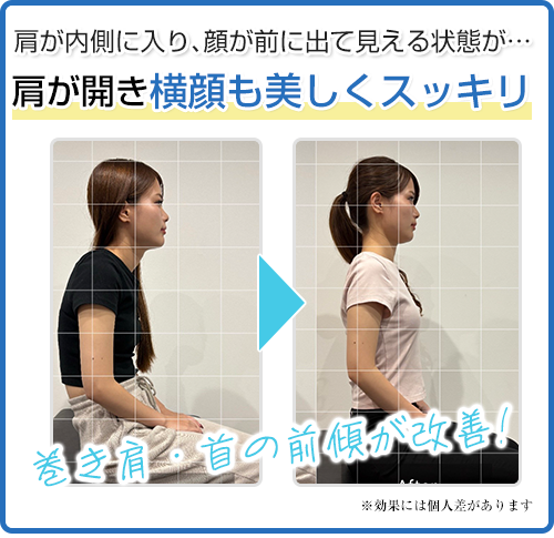 ビフォーアフター